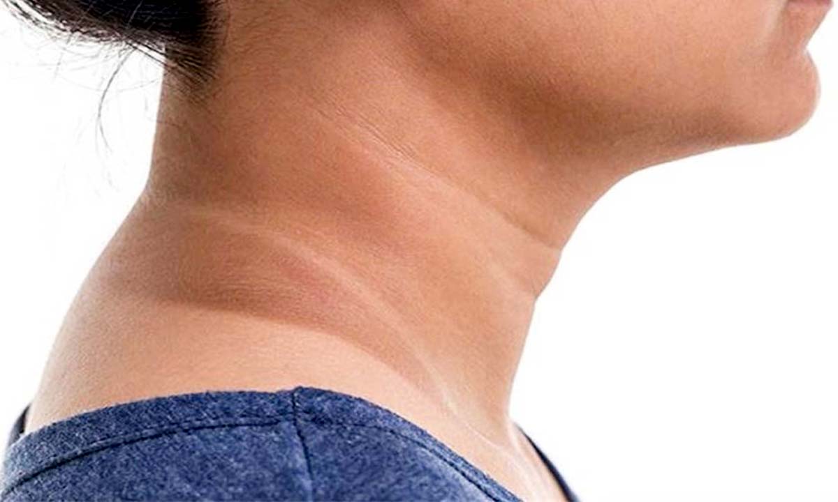 गर्दन की ट्रेनिंग से पीछा छुड़ाने के लिए अपनाएं घरेलू नुस्खे