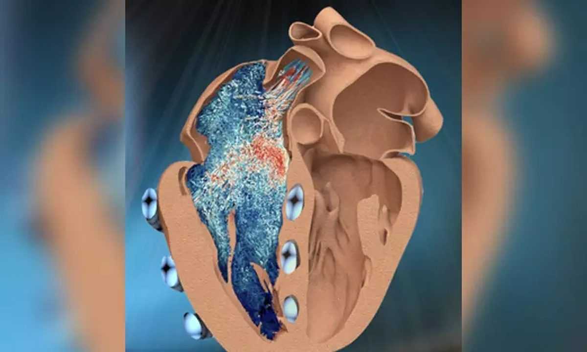 भारतीय मूल के MIT इंजीनियर ने हृदय की रोबोट प्रतिकृति डिजाइन की