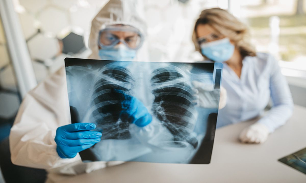 मनुष्यों के शरीर में TB को बनाए रखने वाले तंत्र का पता चला