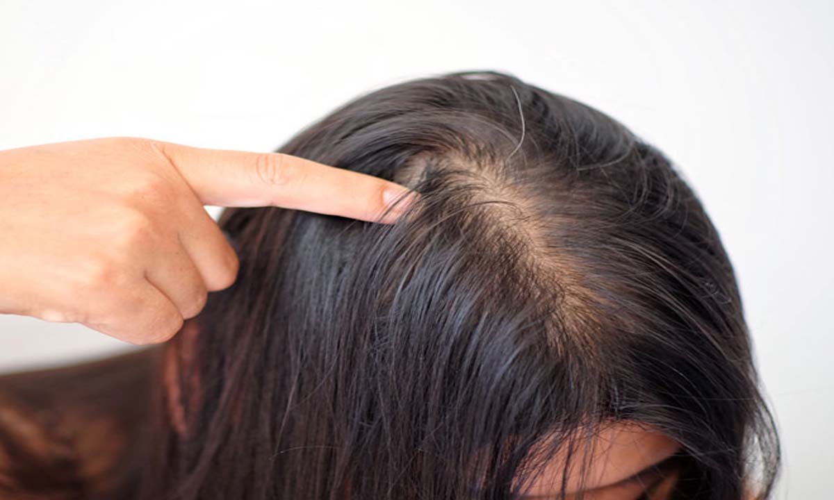 कमजोर बालों से हैं परेशान तो करे ये इस्तेमाल